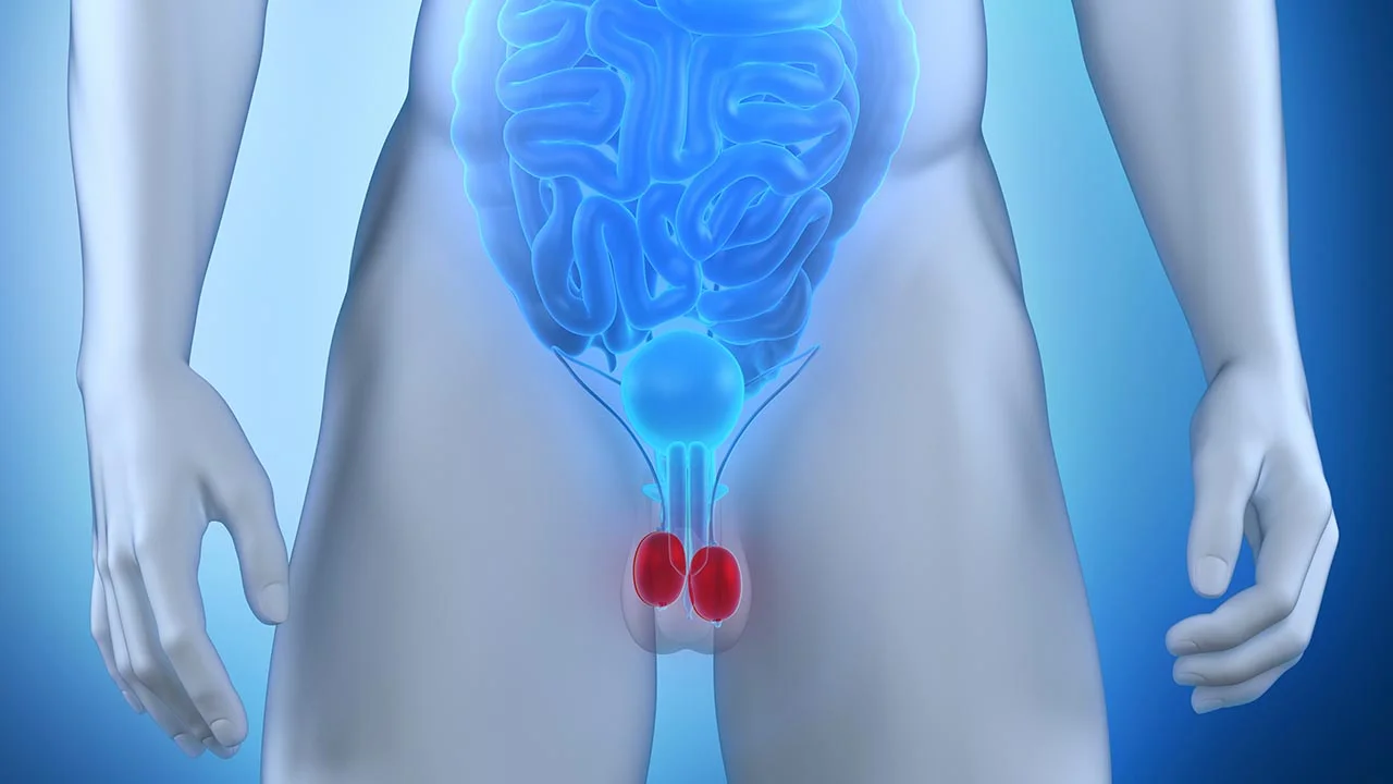 Paget's Disease of the Scrotum