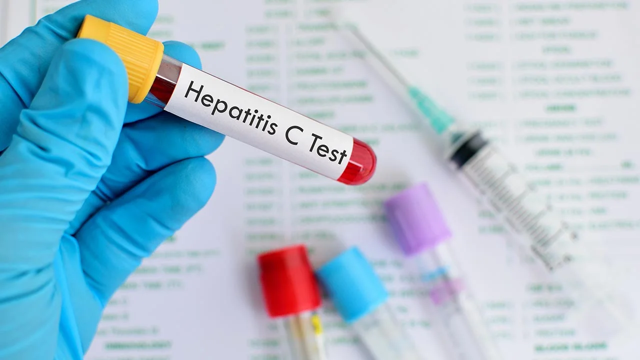 Concerns About Hepatitis C
