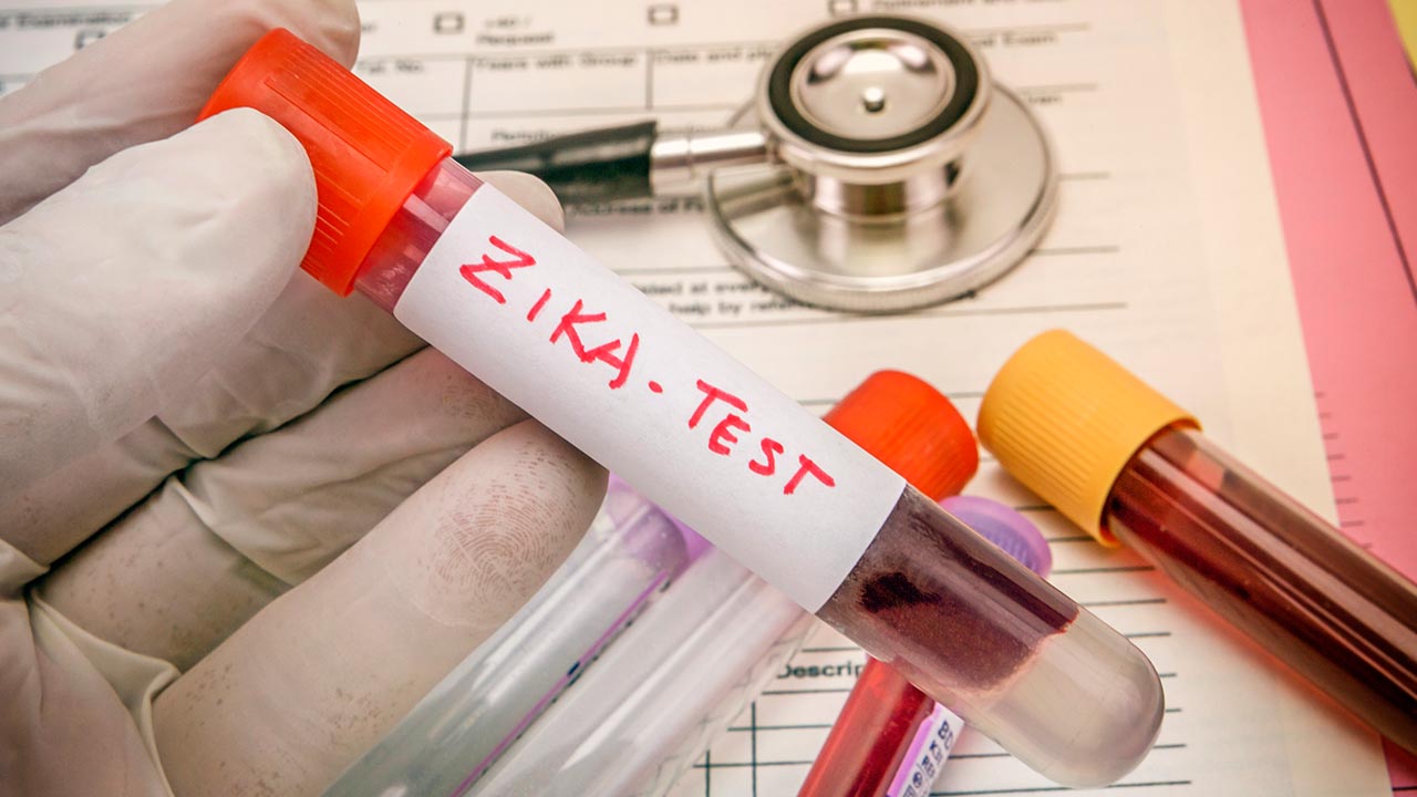 The Anti-Zika Antibody