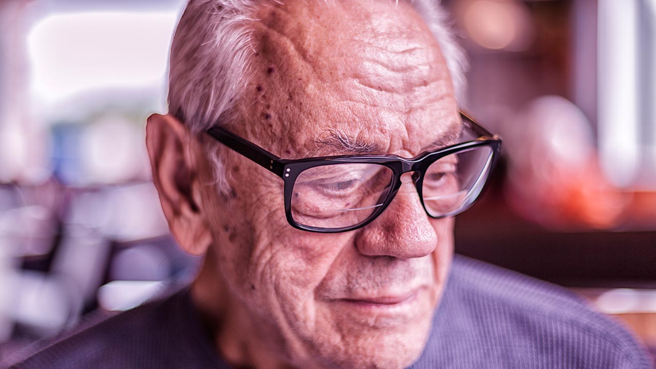 Should You Worry About Seborrheic Keratosis