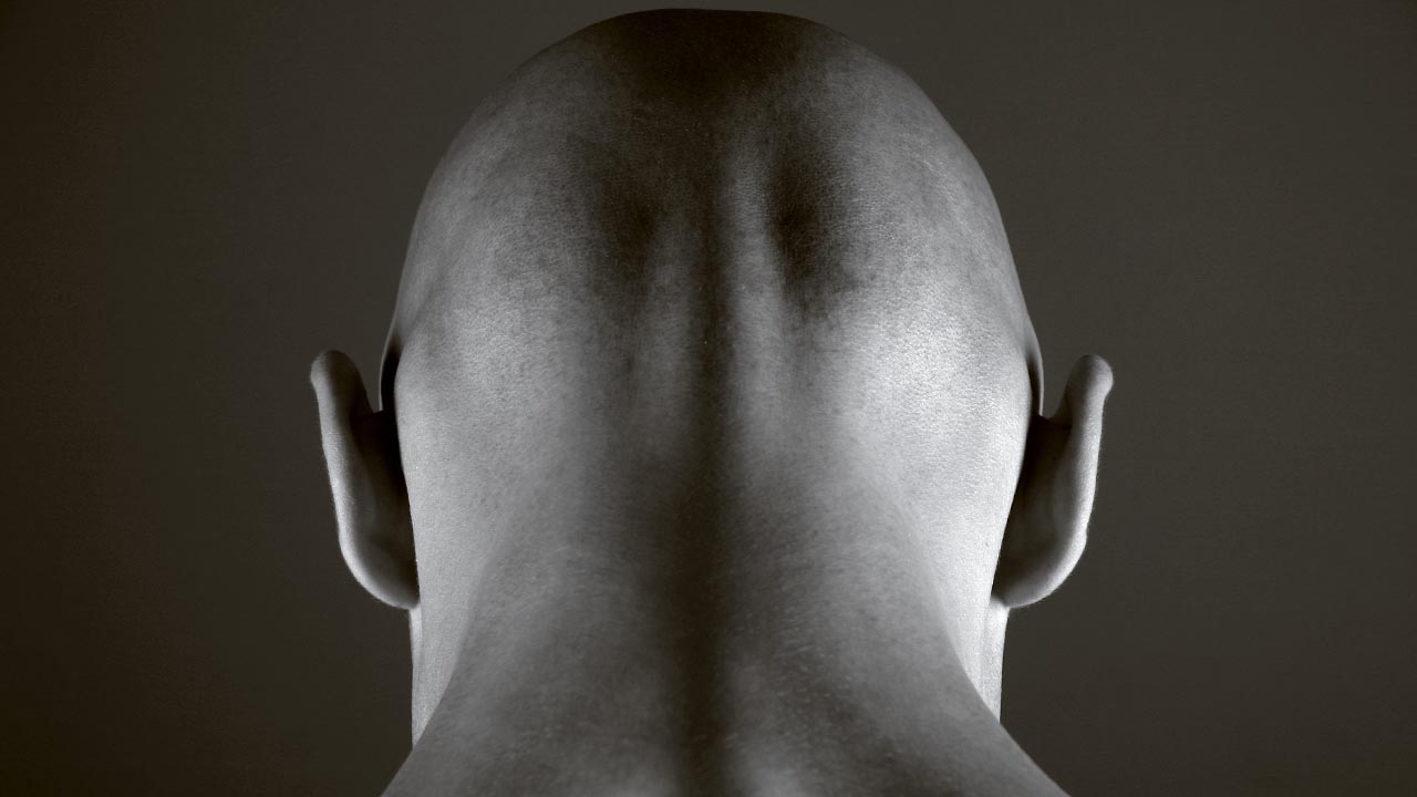 Why Some Men Become Bald