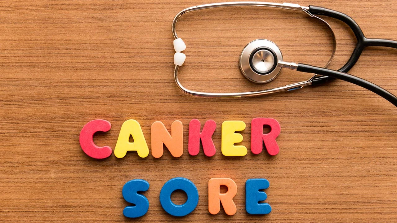 Cold Sore VS. Canker Sore