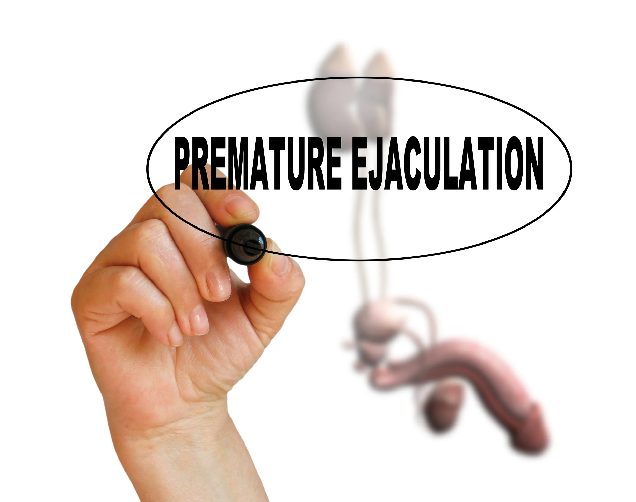 Metabolic syndrome poses significant risk factor for premature ejaculation