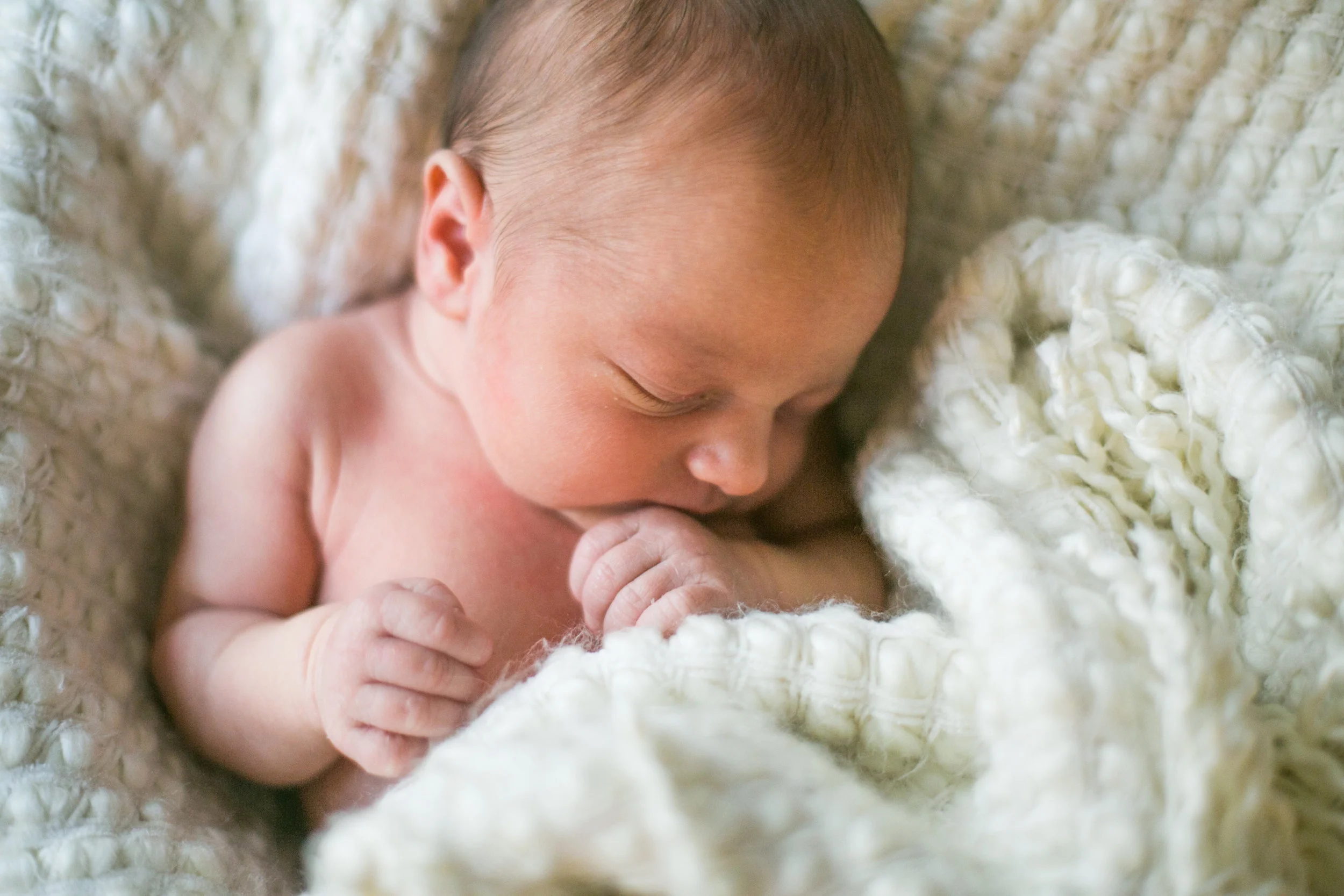 Hypospadias – a common male birth defect