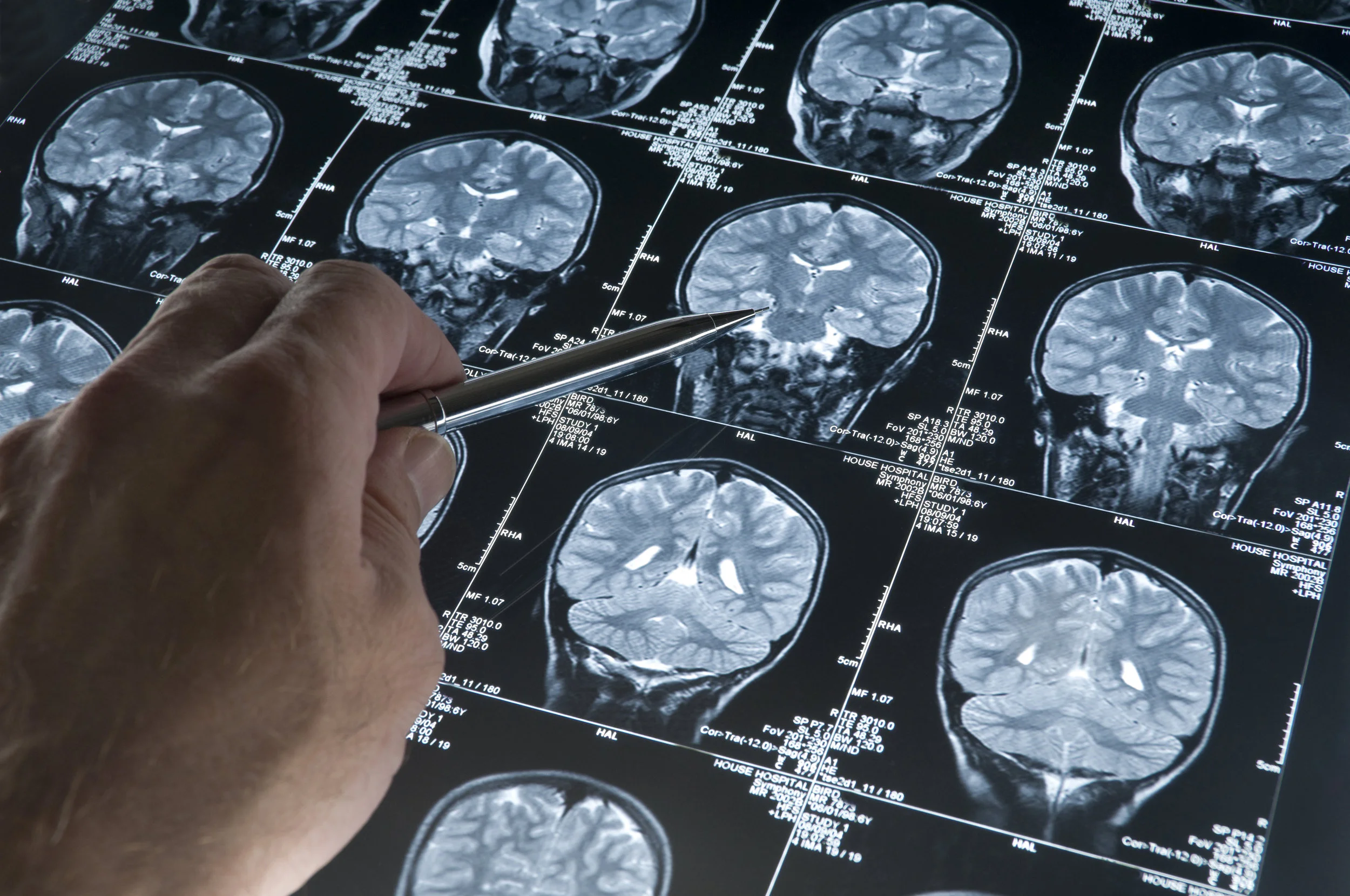 12 signs of someone with Alzheimer’s