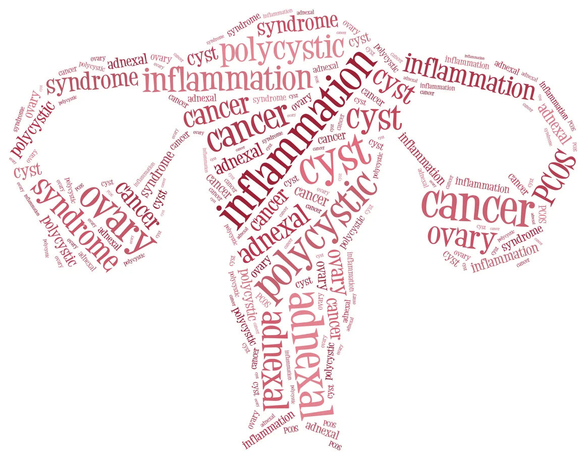 How diet and exercise can help manage polycystic ovary syndrome