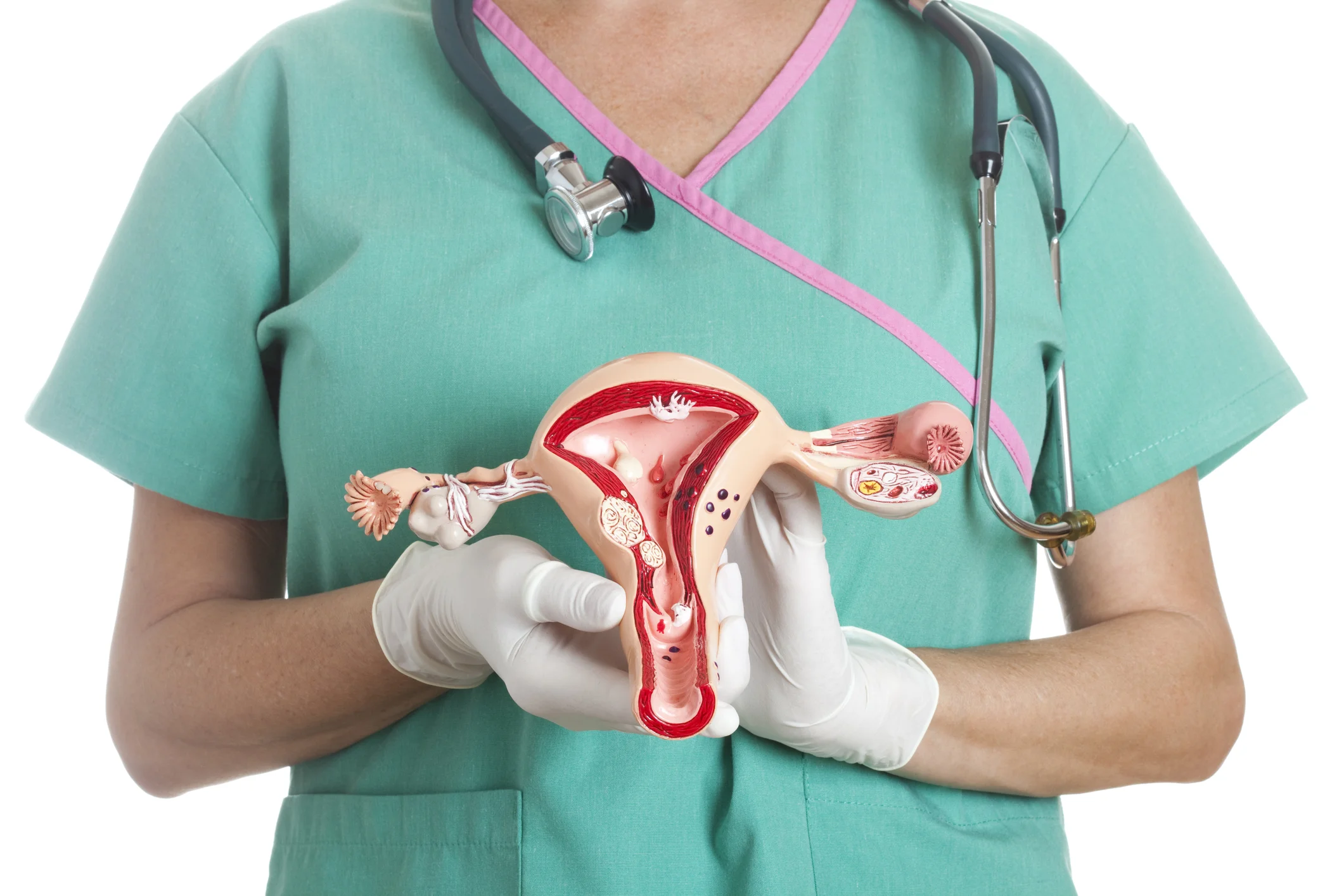 Uterine Fibroids