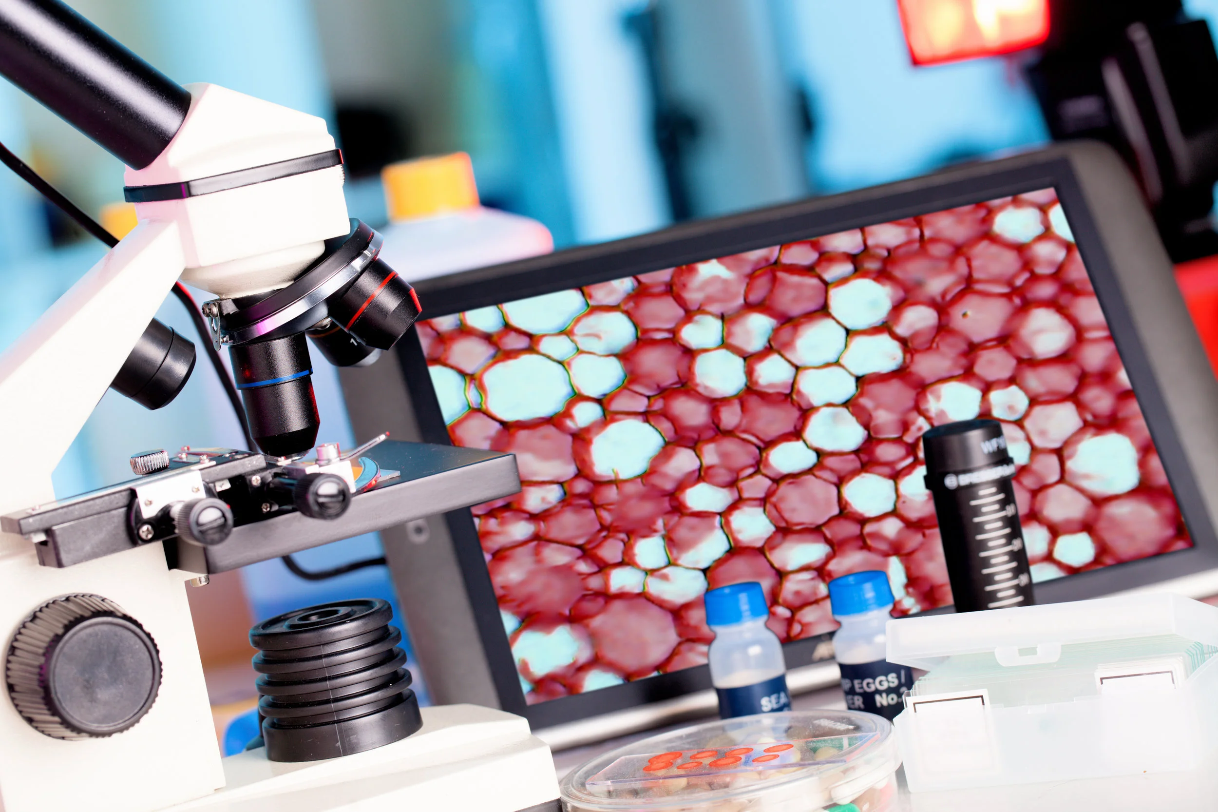 My prostate needle biopsy came back “atypical.” What does that mean?