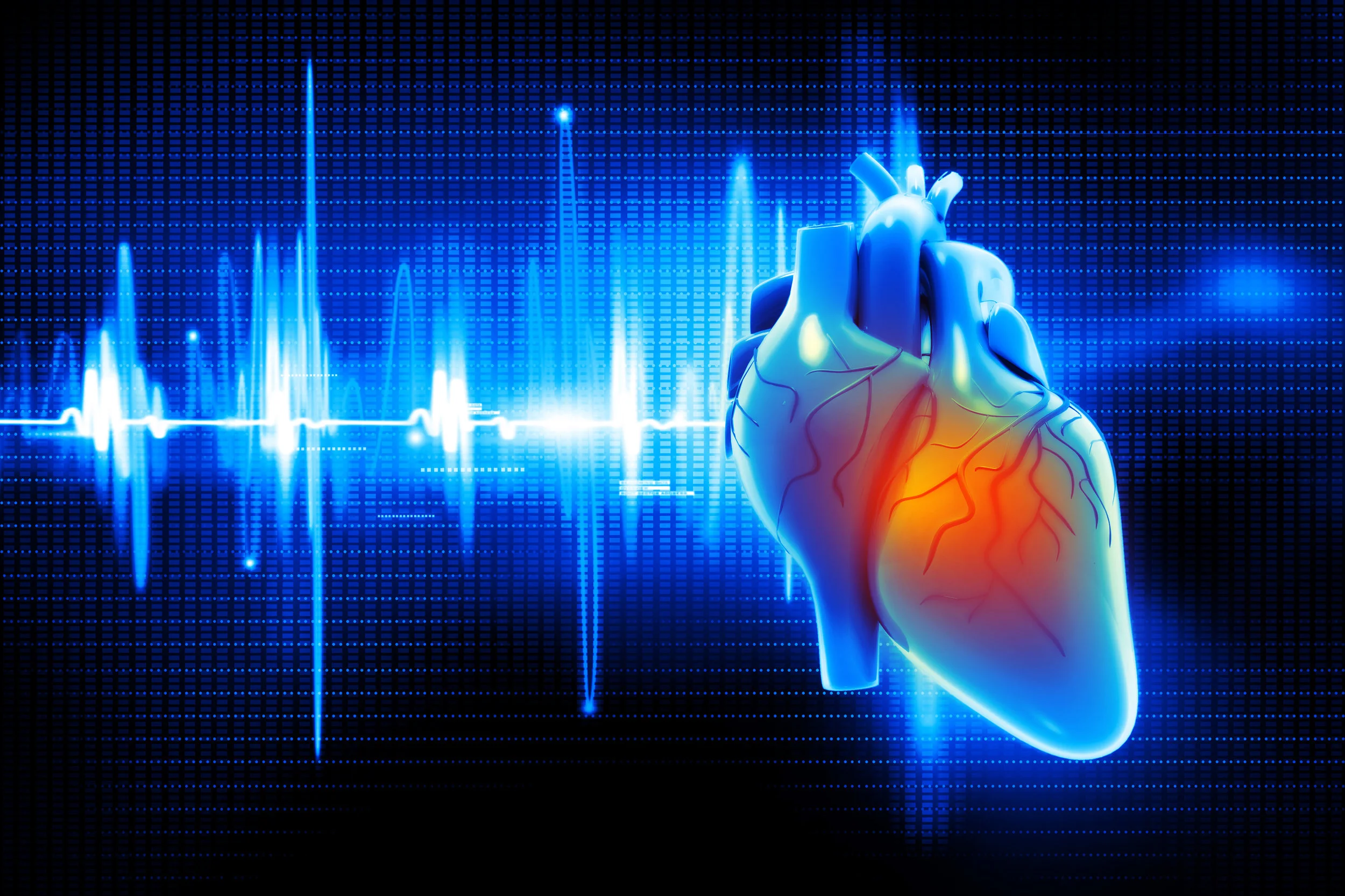 All about atrial fibrillation