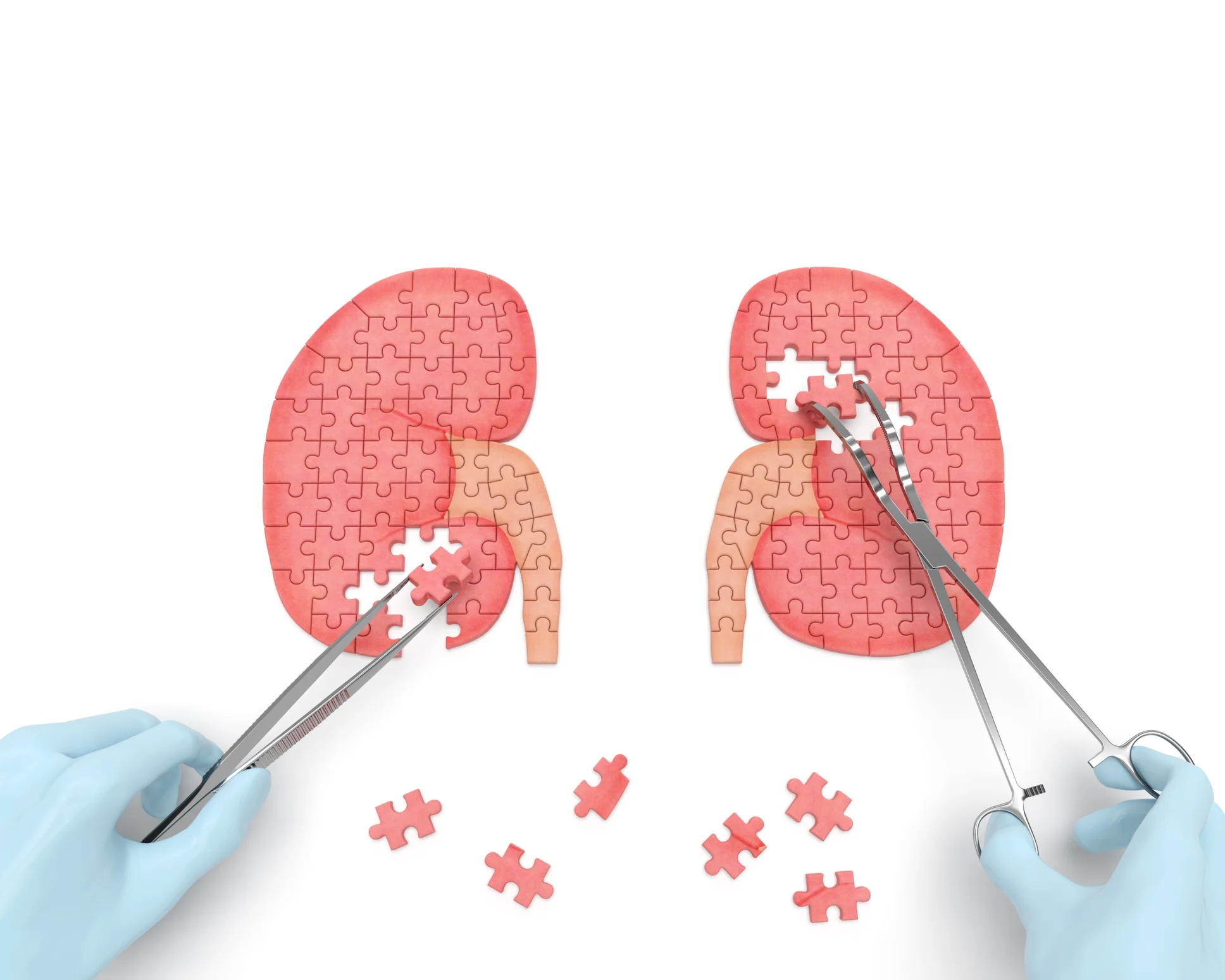 Causes of a swollen kidney