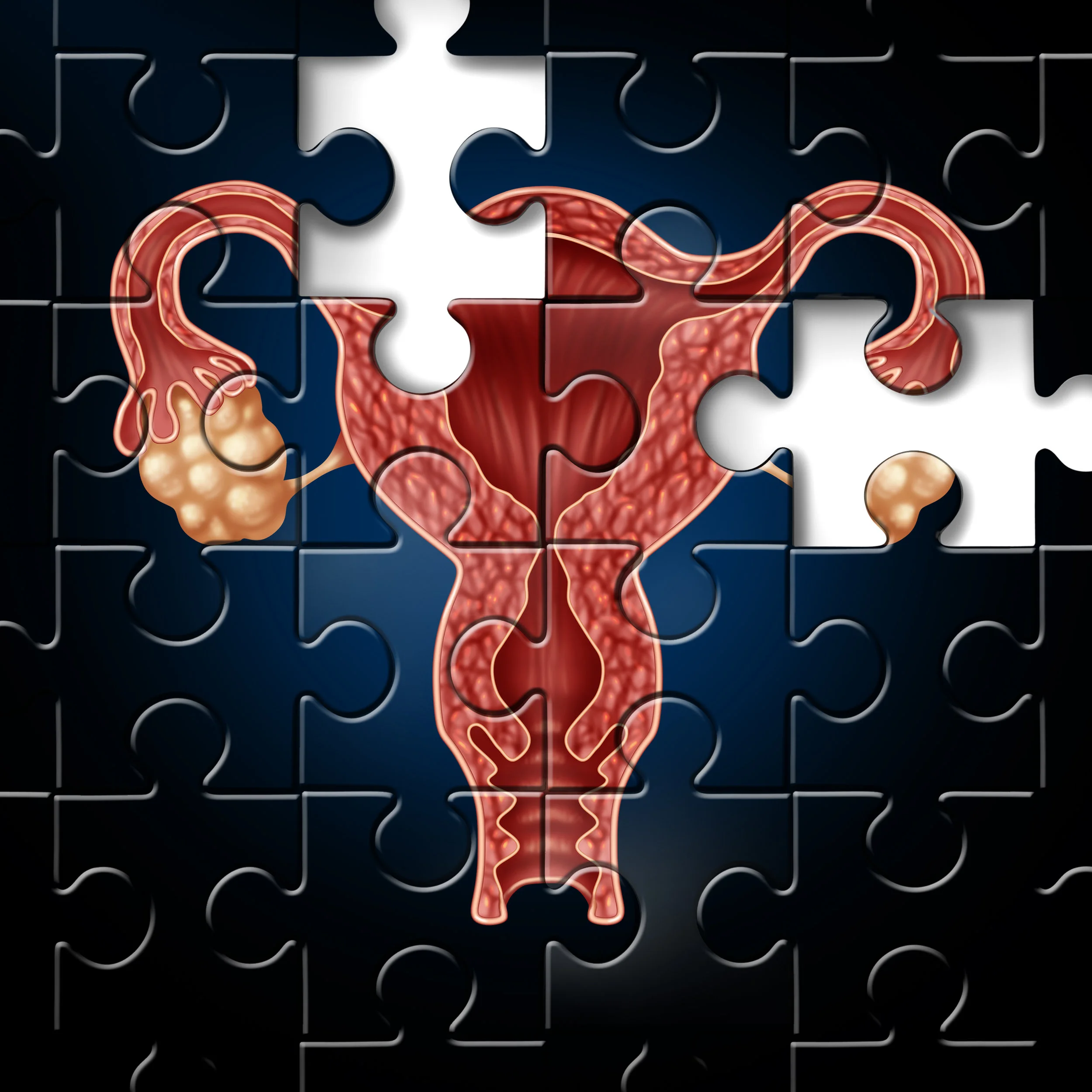 Premature Ovarian Failure