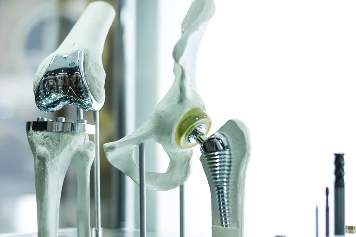 Women and Knee-Hip Surgery