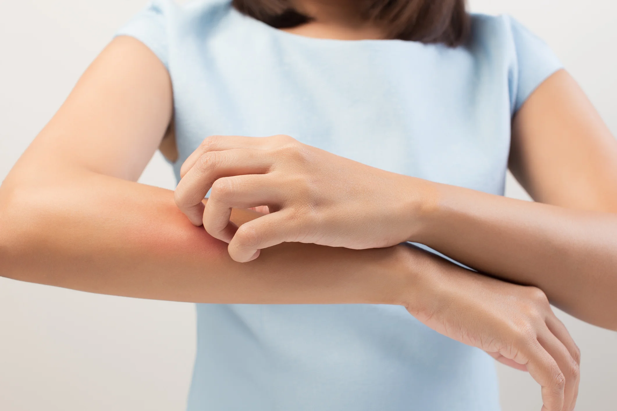 8 skin conditions demanding your attention