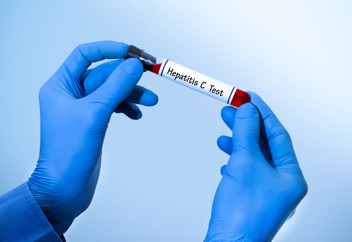 Hepatitis C – a growing threat putting a new generation at risk