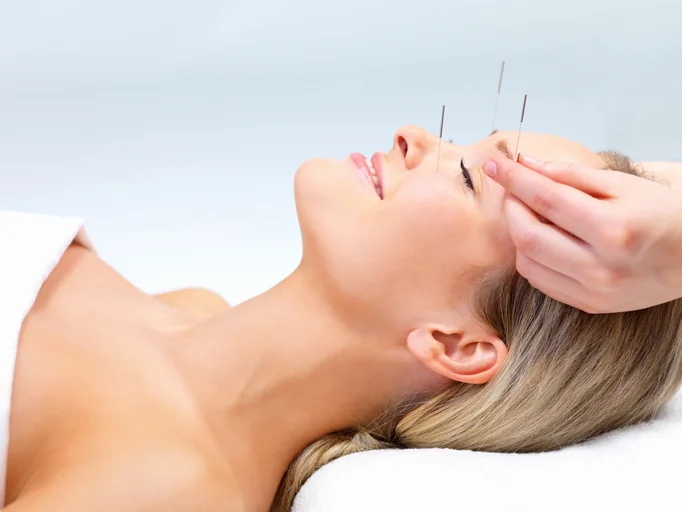 Allay pain with acupuncture