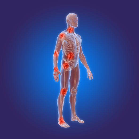 8 ways easing the pain of psoriatic arthritis