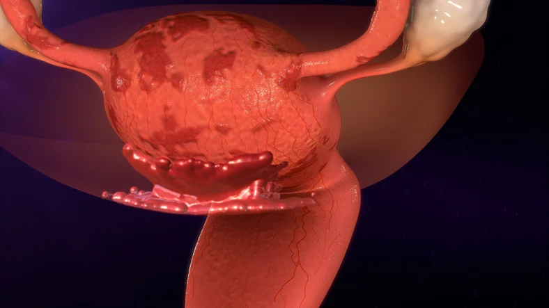 10 facts women should know about endometrial cancer