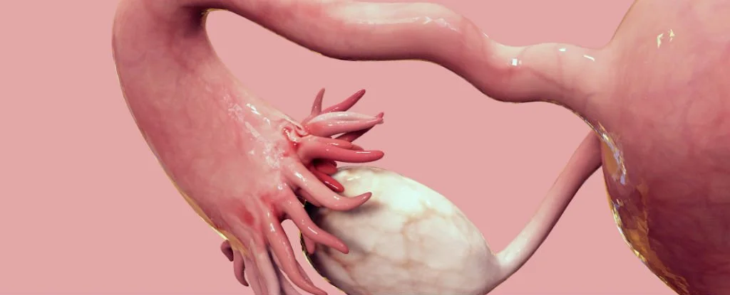 3D Printed Ovaries: New Research Shows Progress