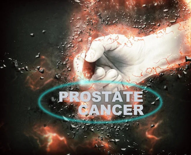 Staging the disease of prostate cancer