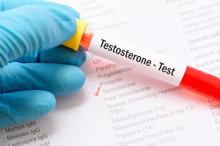 Testosterone boosted with exercise in overweight men
