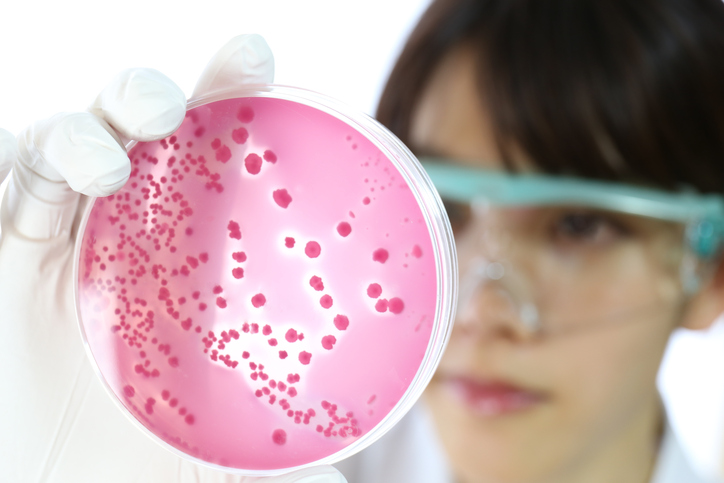 5 common sources of food poisoning
