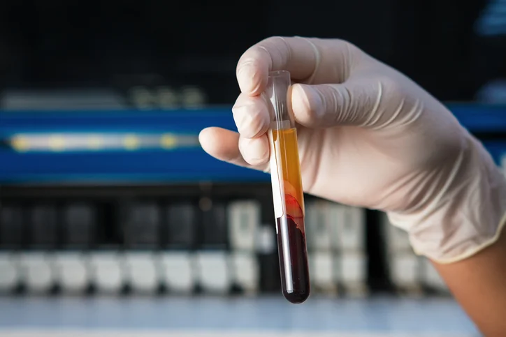 6 necessary steps to prevent DVT