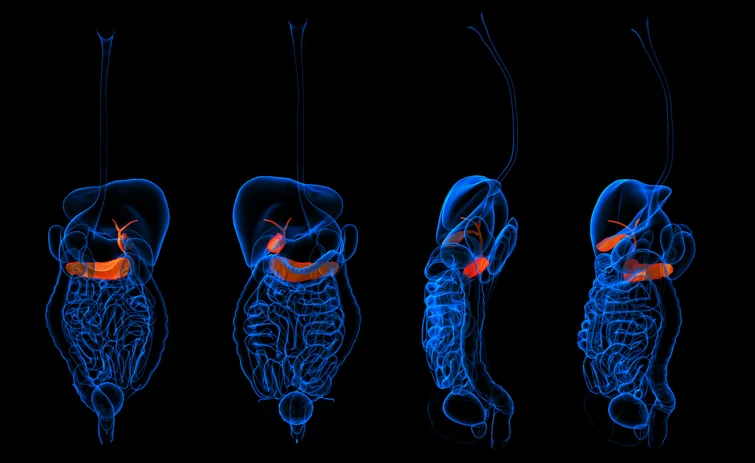 When the pancreas becomes inflamed