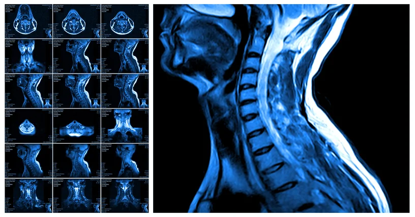 Head and neck cancer warning signs
