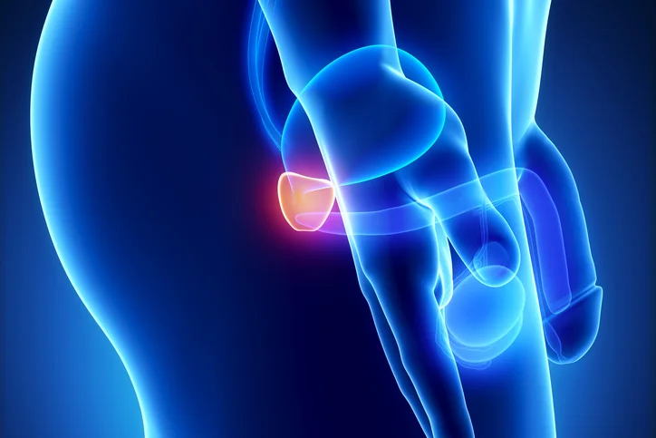 Study shows anti-hormone treatment combined with PARP inhibitor may prevent progression of prostate cancer