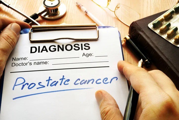 Study finds association between periodontal disease and prostate cancer