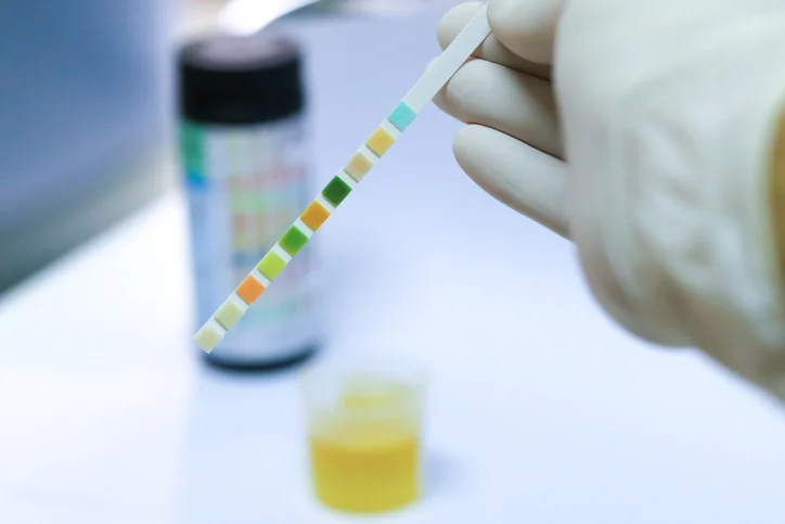 Why urine color can be a clue to your health