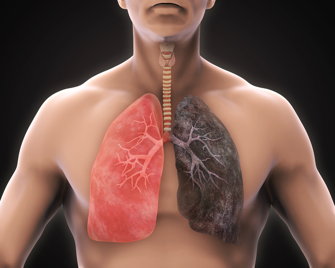 8 lifestyle changes to make living with COPD better