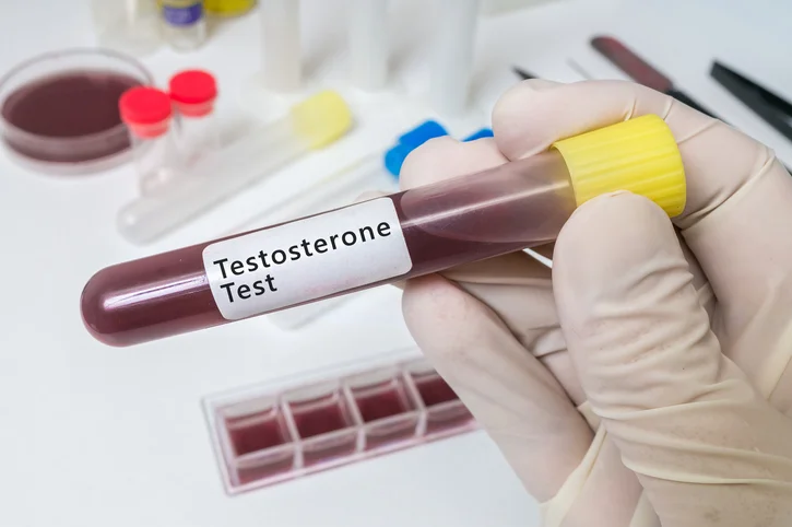 9 subtle signs a man has low testosterone