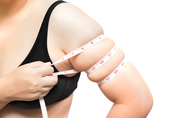 More U.S. adults obese than ever before