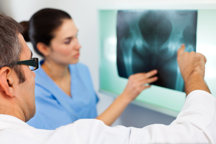 Exercise two minutes a day to keep hip fractures away