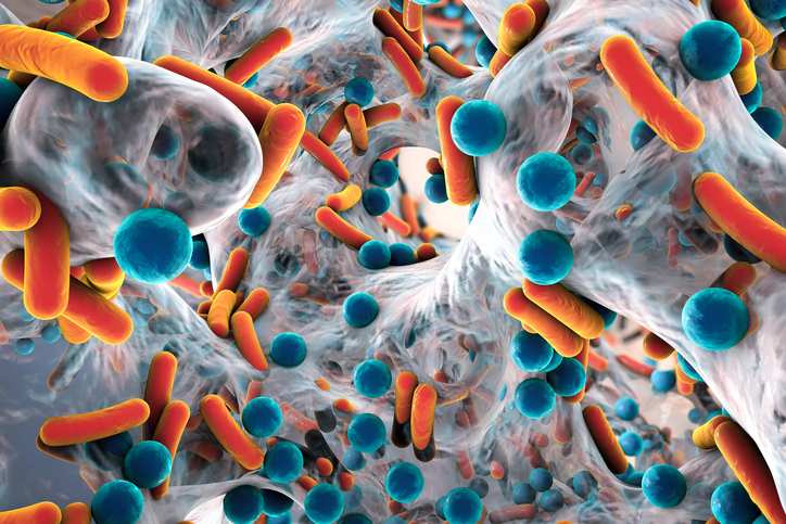 Treating bacterial vaginosis