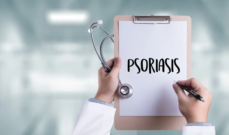 7 things about psoriasis you may not know
