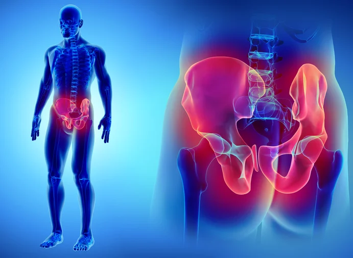 Women and pelvic inflammatory disease