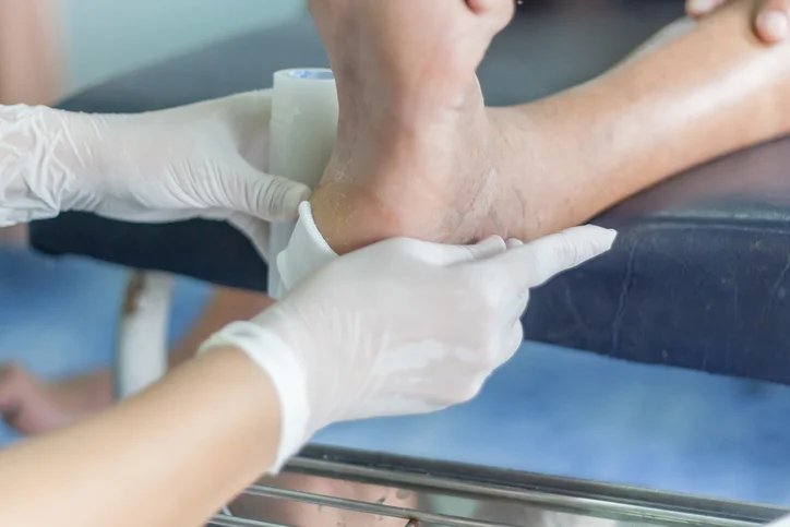 Test your knowledge on diabetic foot ulcers