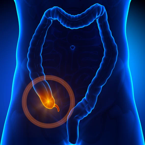 Know the warning signs of appendicitis