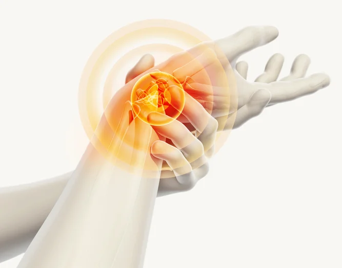 Could you have carpal tunnel syndrome?