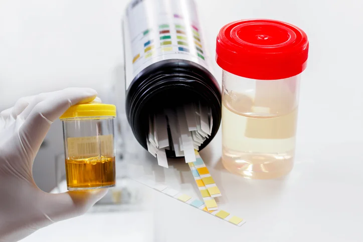 Is blood in urine always serious?