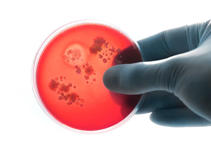 Know the difference between bacterial and viral meningitis