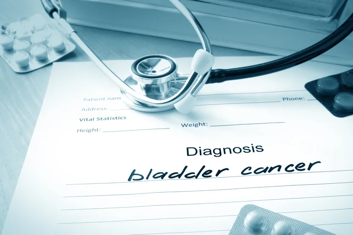 What men should know about bladder cancer