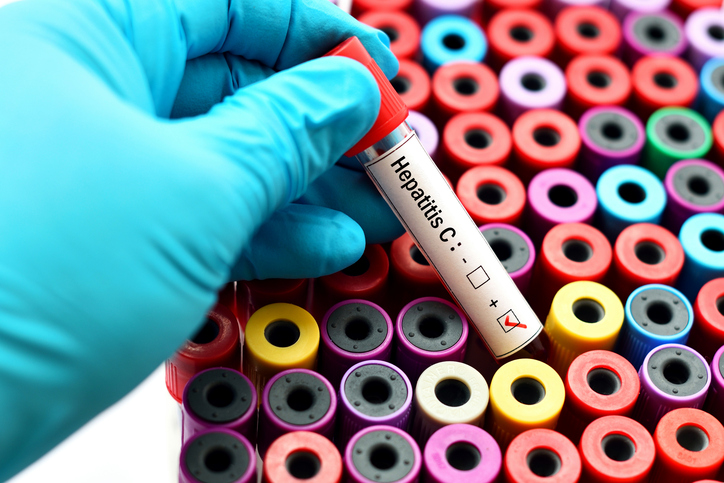 Could you be at risk for hepatitis C?