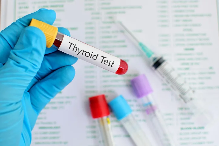Hashimoto’s disease – the most common cause of hypothyroidism