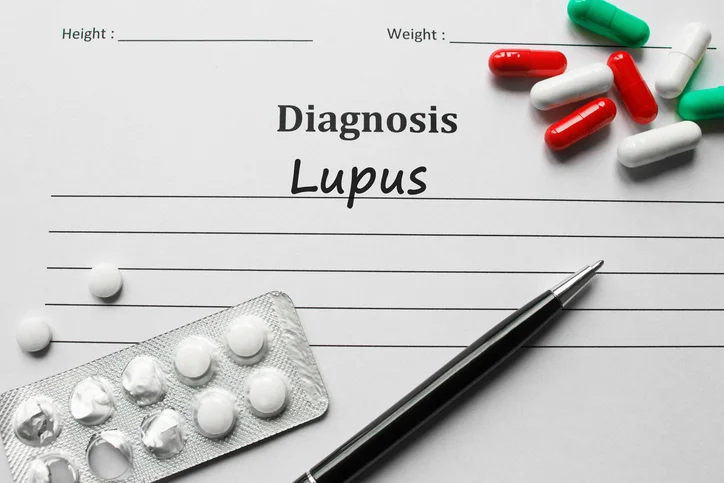 8 surprising facts you need to know about lupus