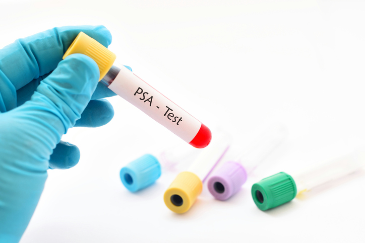  PSA pop quiz testing your knowledge