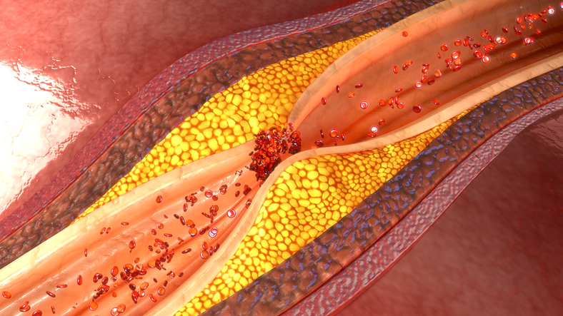 10 surprising facts about cholesterol you should know