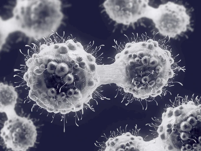 Understanding prostate cancer from diagnosis to treatment